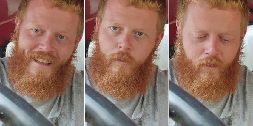 oliver anthony thought he might die before viral rise to fame my body was falling apart