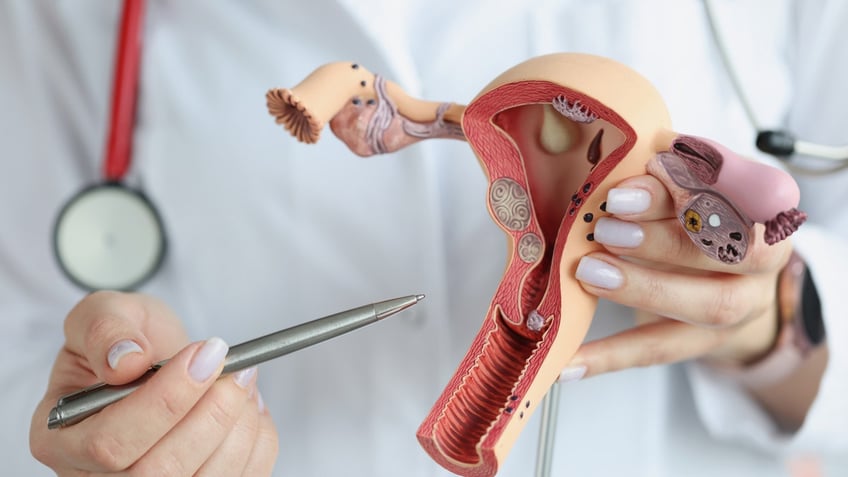 Doctor holding a model of female reproductive organs