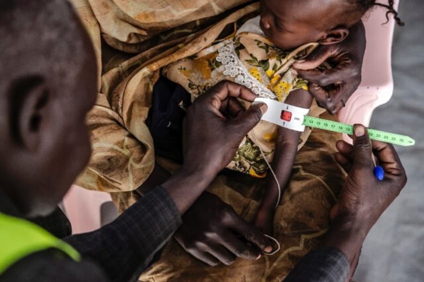 A health worker measures a Sudanese child's arm at a clinic in Renk, in neighbouring South