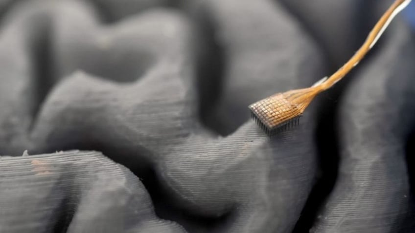 The AI learns to map these patterns to specific sounds, reconstructing speech in real-time. 