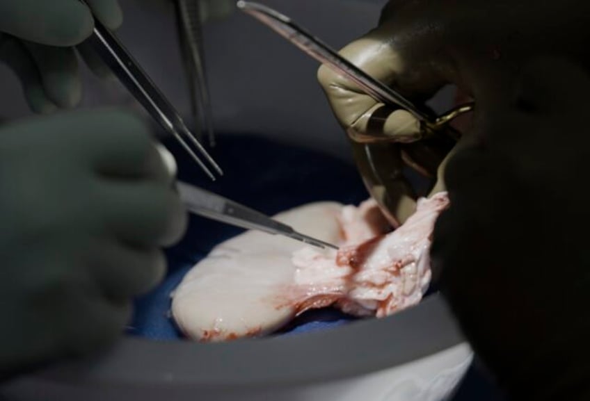 pig kidney works in a donated body for over a month a step toward animal human transplants