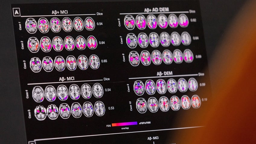 Brain scans