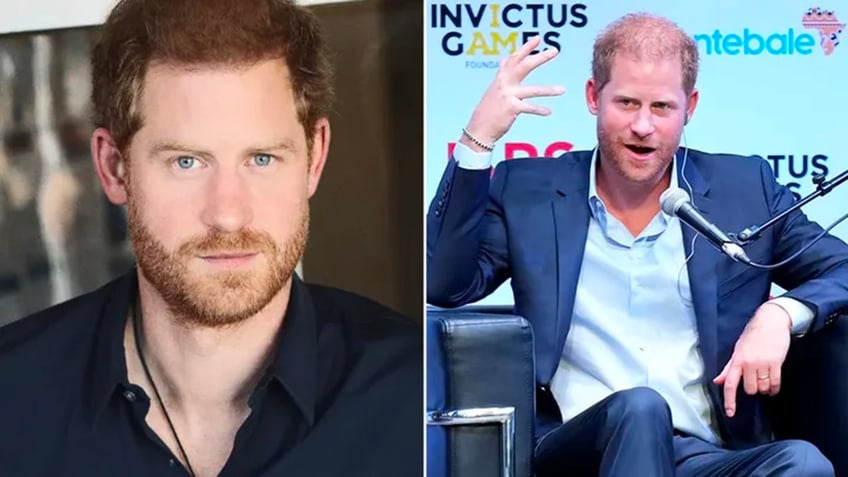 split side-by-side image of Prince Harrys hair