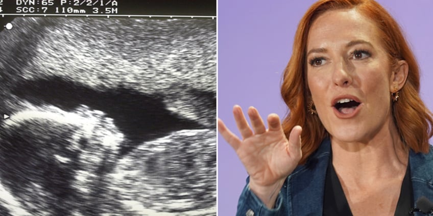 psaki repeats claim that dems dont support abortion until birth entirely misleading