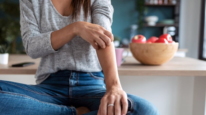 Woman scratching