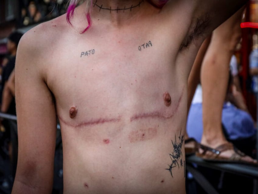 A protester with the scars of mastectomy seen along Bravo Murillo street during the demons