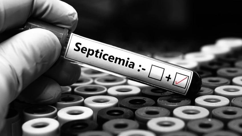 Sepsis test