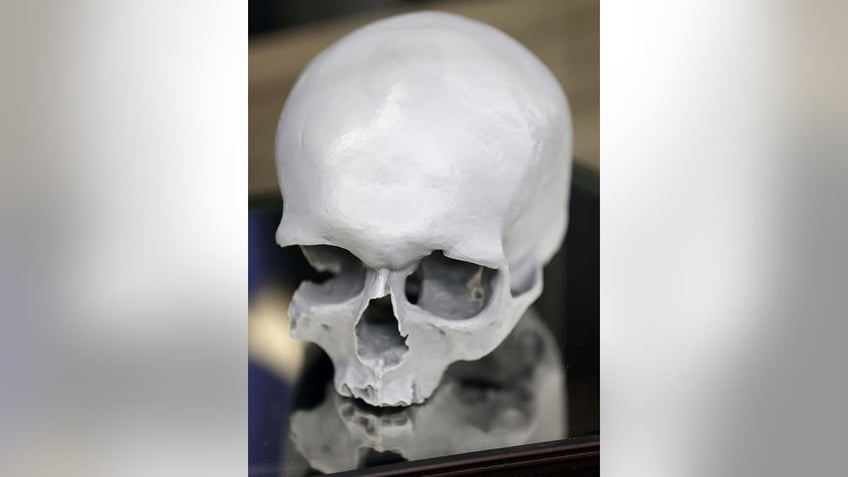 3D Print of skull