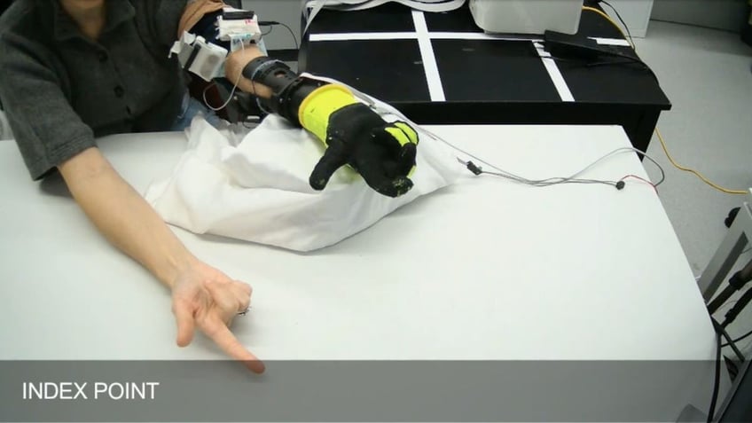 robotic prosthetic 6