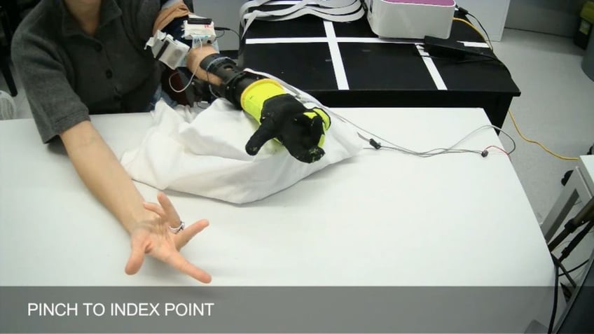 robotic prosthetic 4