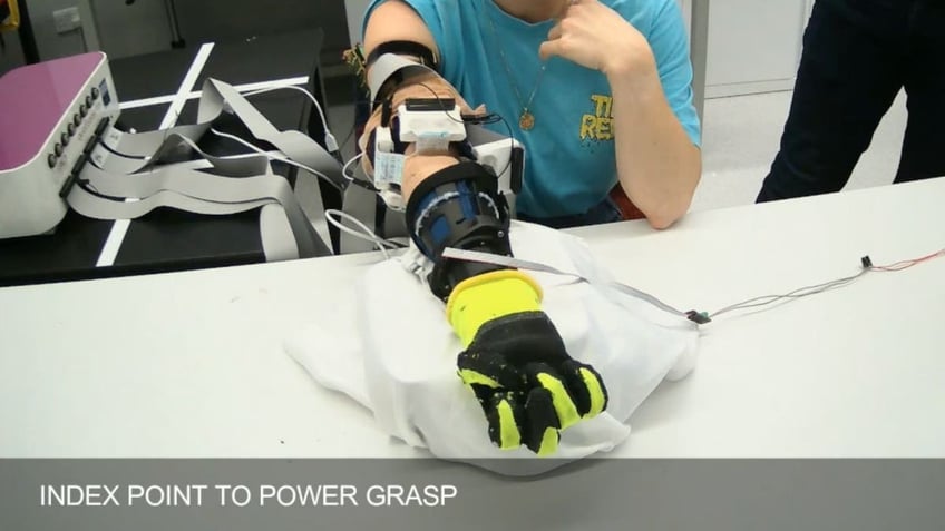 robotic prosthetic 5