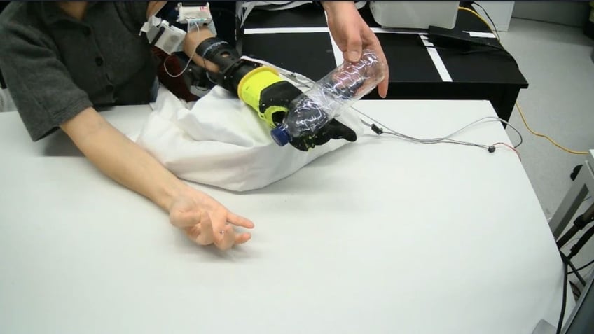 robotic prosthetic 3