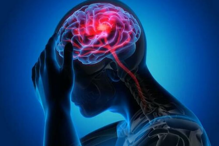 stroke could be transmissible study finds