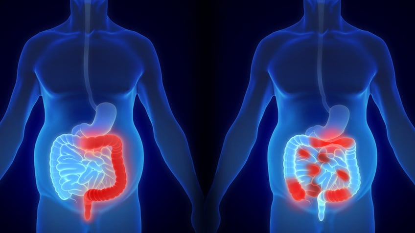 IBD diagram