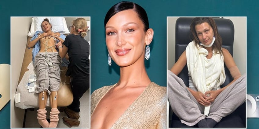 supermodel bella hadid shares treacherous lyme disease battle in new pictures invisible suffering