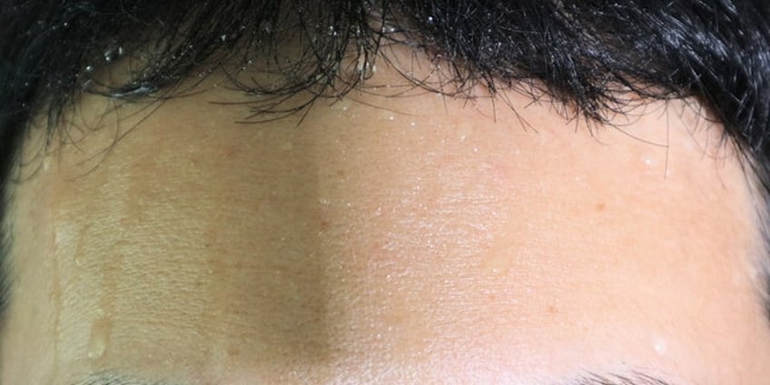 sweating excessively heres what you can do to reduce it
