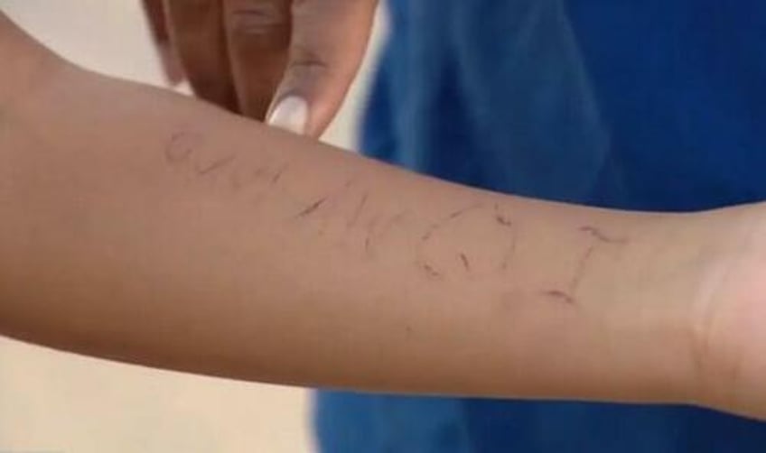 texas middle schoolers secretly tattooed each other using shared needle in classrooms