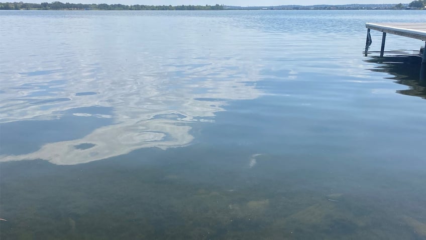 texas resident dies from rare amoeba infection after swimming in lake