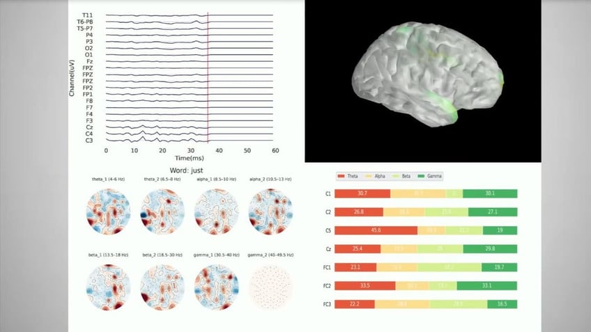 This mind-reading tech using AI can convert brain activity into text