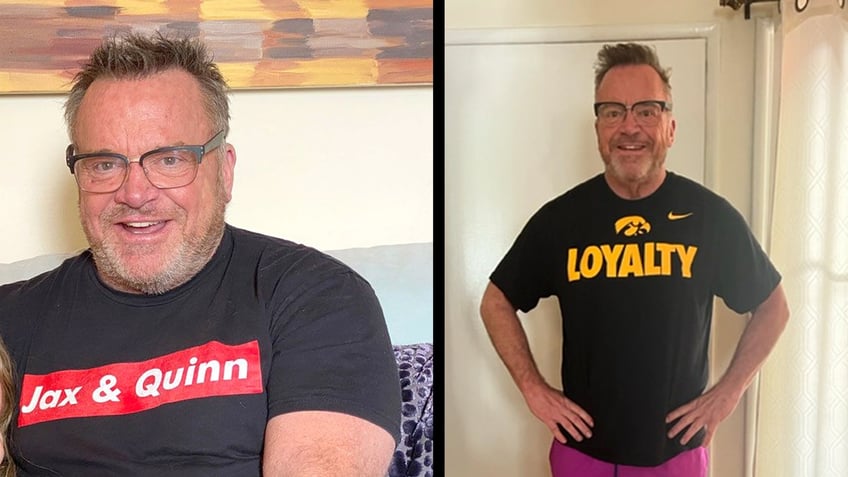 tom arnold before and after weight loss