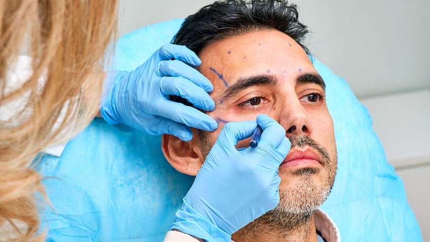 painting the face of a 45-year-old man for an aesthetic treatment with botulinum toxin