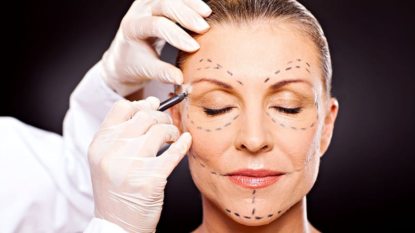 middle aged woman with correction marks preparing for plastic surgery