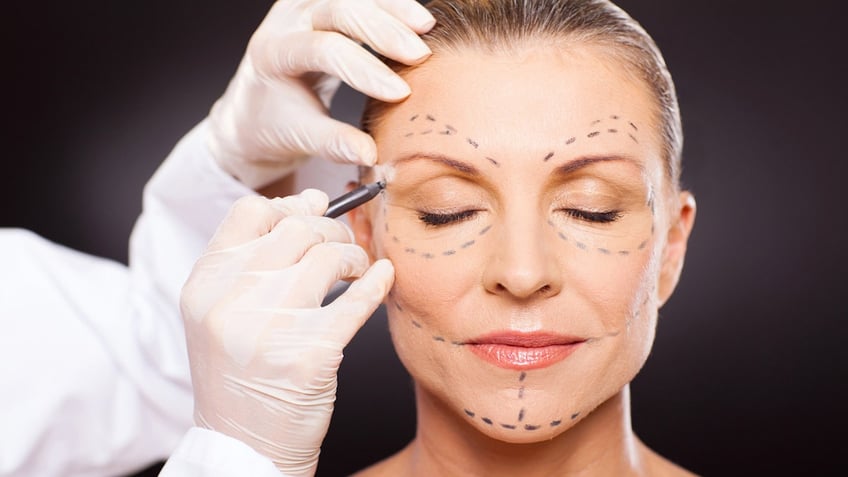 top plastic surgeries these were the most in demand procedures in 2022