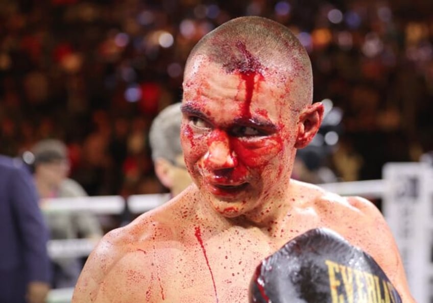 Tim Tszyu's super-welterweight title fight is off because of this head wound