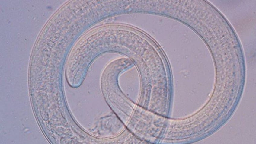 parasite larvae