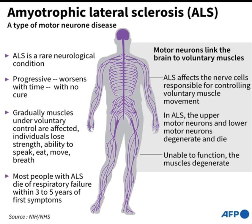 Amyotrophic lateral sclerosis (ALS) is an incurable degenerative disease