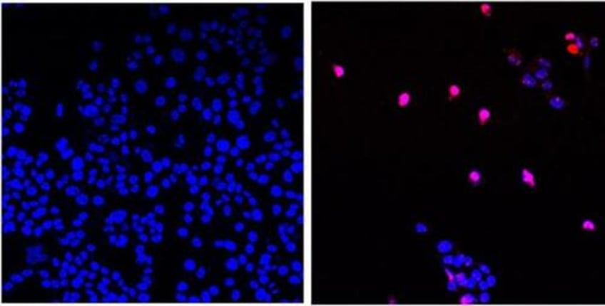 us scientists develop new cancer stopping pill that can annihilate tumors