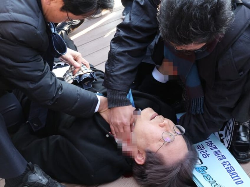 BUSAN, SOUTH KOREA - JANUARY 02: (EDITORS NOTE: The identity of people in this image has been obscured at the request of the image source; image pixelated by source) In this handout image provided by The Busan Daily News, Lee Jae-myung, leader of the main opposition Democratic Party, lies down …