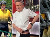 Watch: Badly Wounded Gordon Ramsay Shows Off Massive Bruise, Says Bike Helmet Saved His Life