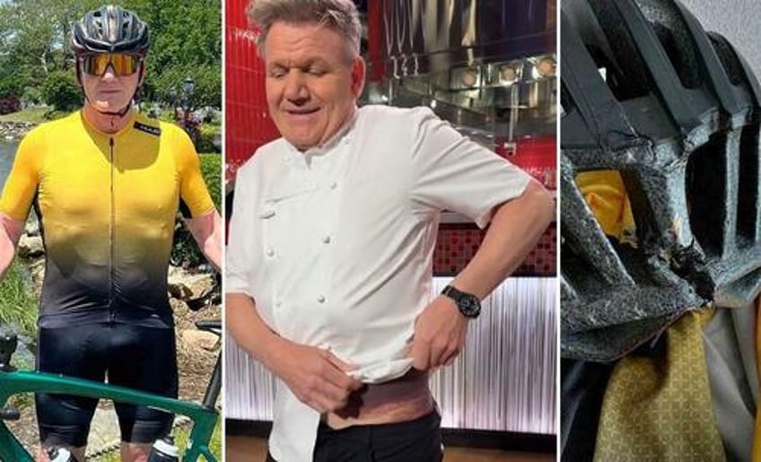 watch badly wounded gordon ramsay shows off massive bruise says bike helmet saved his life