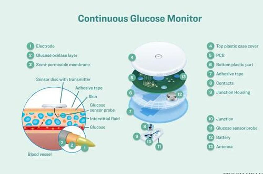 wearing a continuous glucose monitor troubling trend or health hack