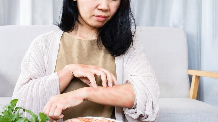 Woman food allergy