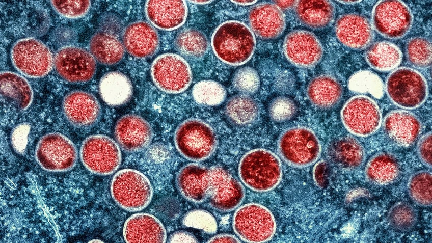 A colorized transmission electron micrograph shows red monkeypox particles found within an infected cell.