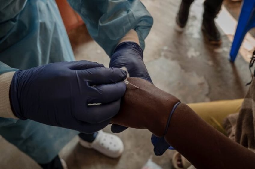 Democratic Republic of Congo and other African countries battling mpox outbreaks do not ha