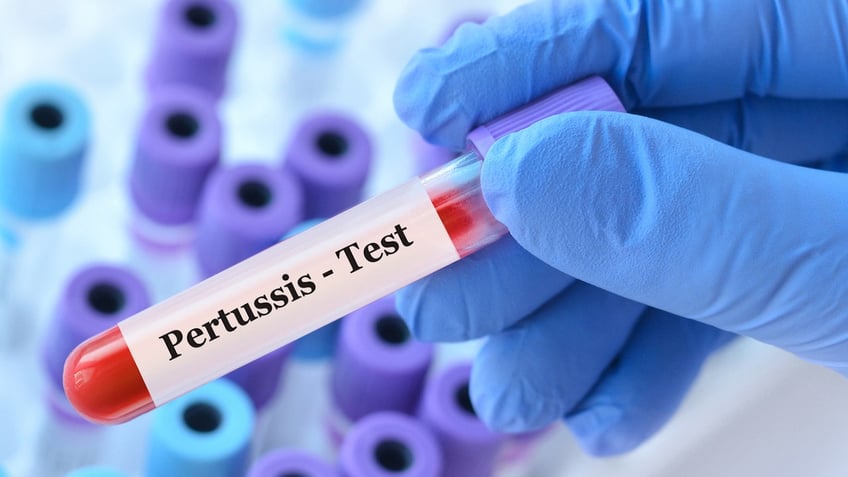 Pertussis test