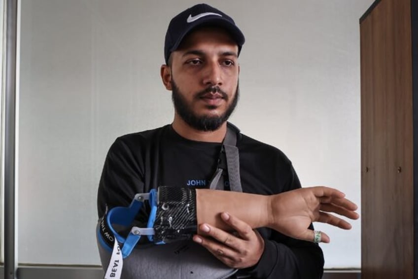 Bangladeshi students who lost their hands during protests to overthrow the government in A