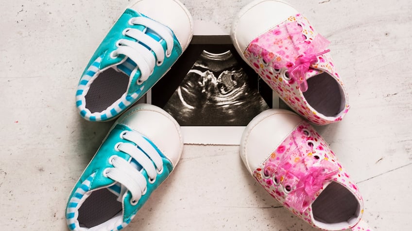 Blue and pink booties next to baby photos with ultrasound in the 20th week of pregnancy.